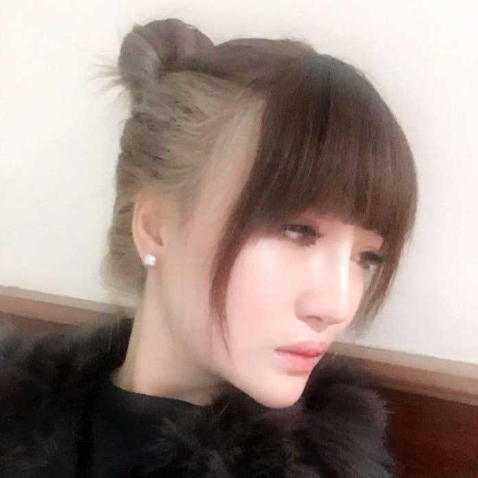 Độn cằm