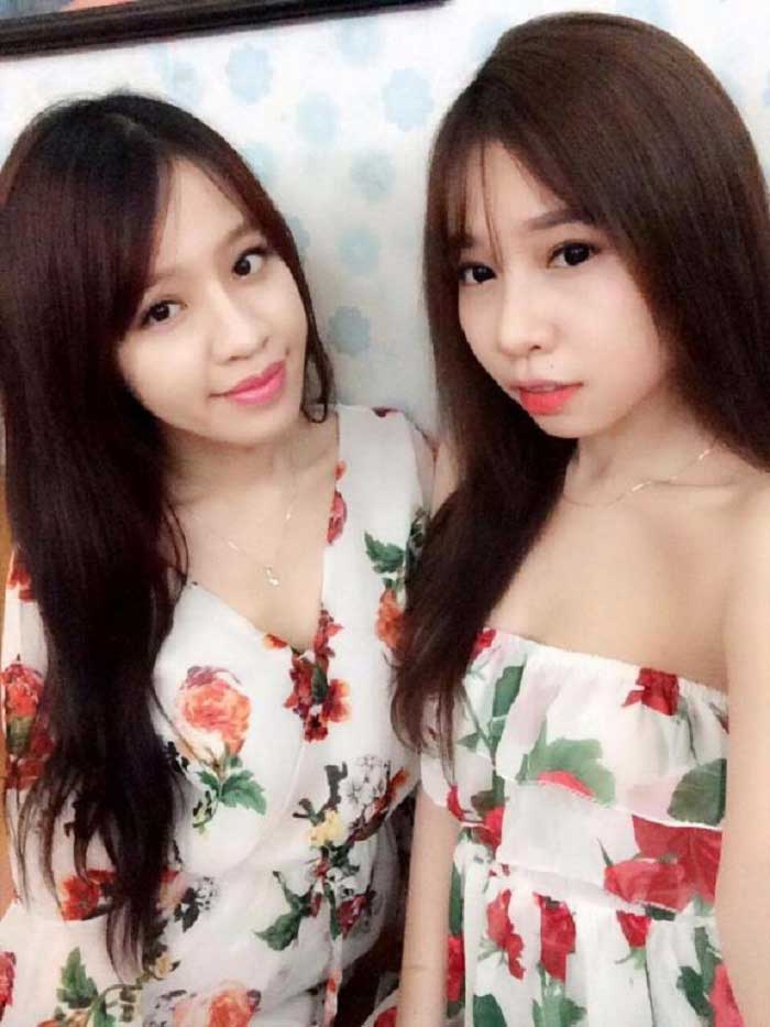 Nâng mũi bọc sụn