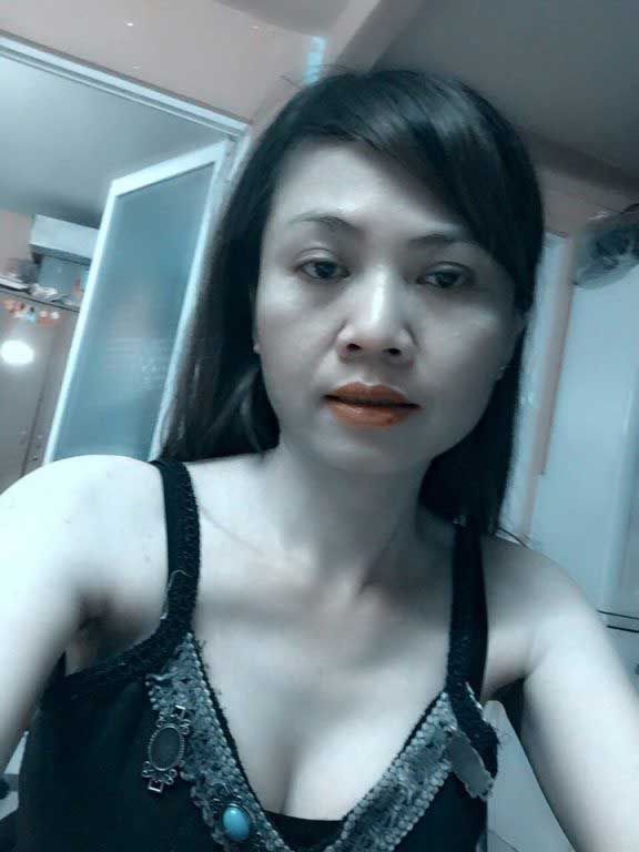 Nâng ngực nội soi