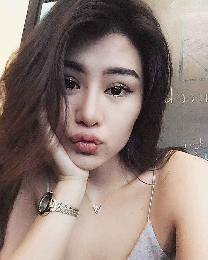 Cắt mí mắt