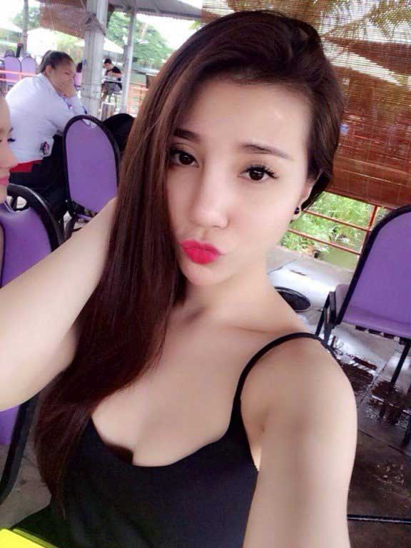 Nâng ngực nội soi