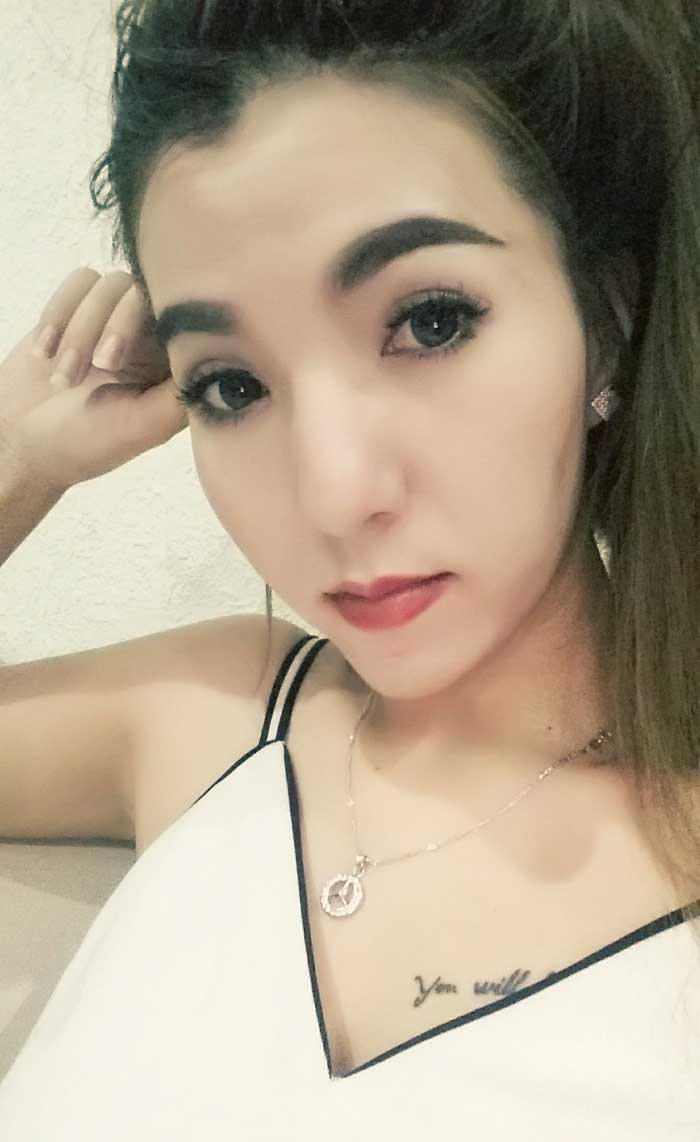 Cắt mí mắt
