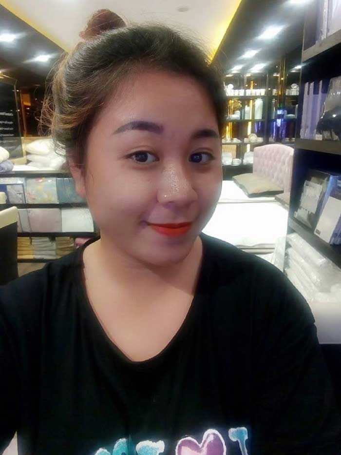 Cắt mí mắt