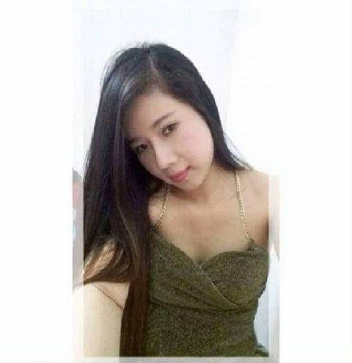 Nâng mũi bọc sụn