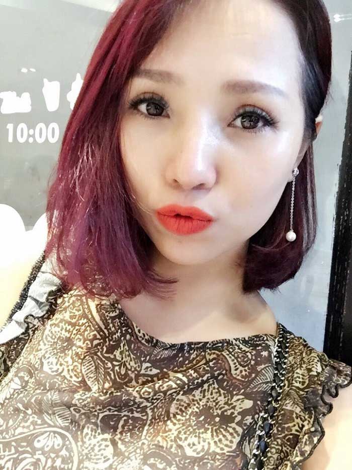 Cắt mí mắt