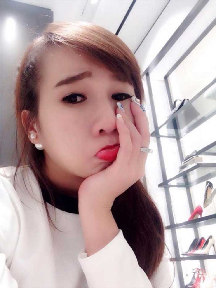 Nâng mũi bọc sụn