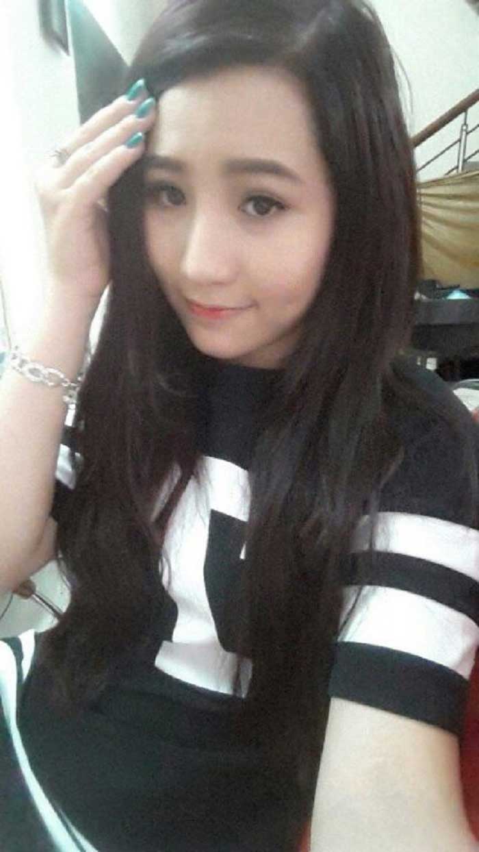 Nâng mũi bọc sụn