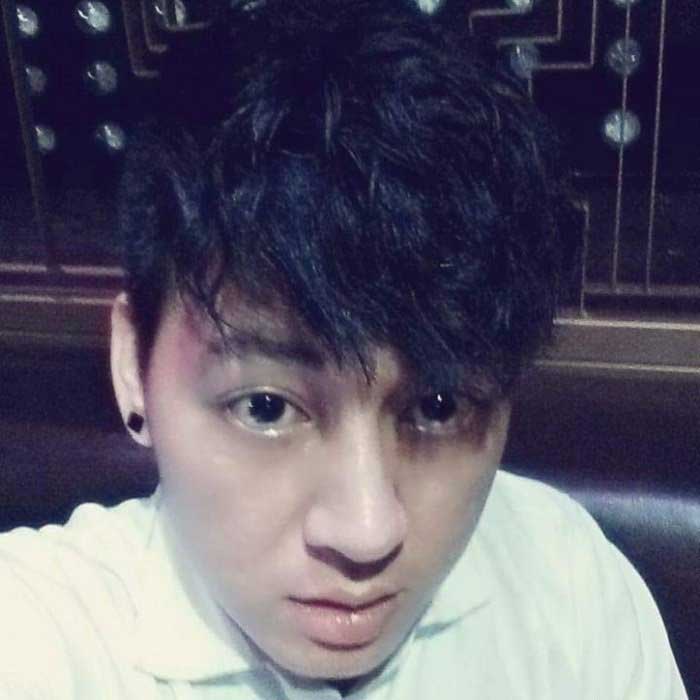 Nâng mũi bọc sụn