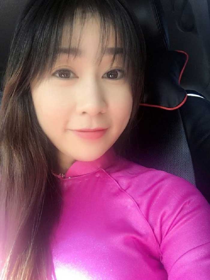 Cắt mí mắt