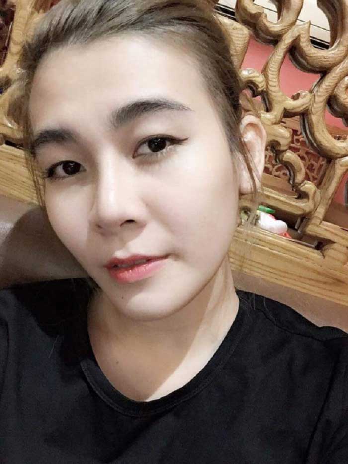 Nâng mũi Hàn Quốc