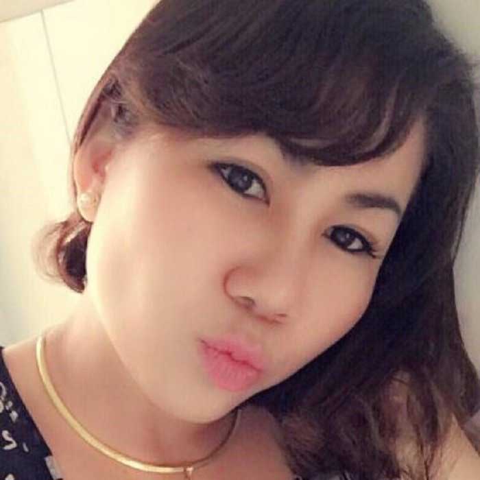Cắt mí mắt