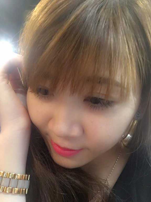 Bấm mí Hàn Quốc