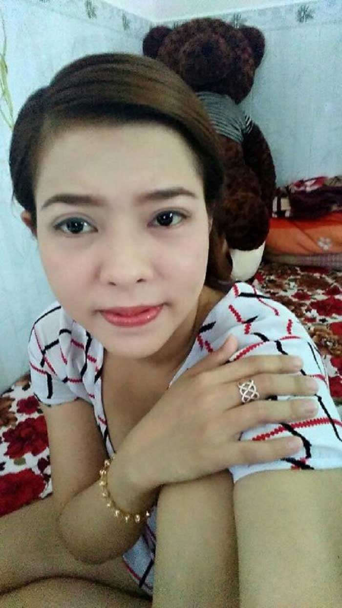 Cắt mí mắt