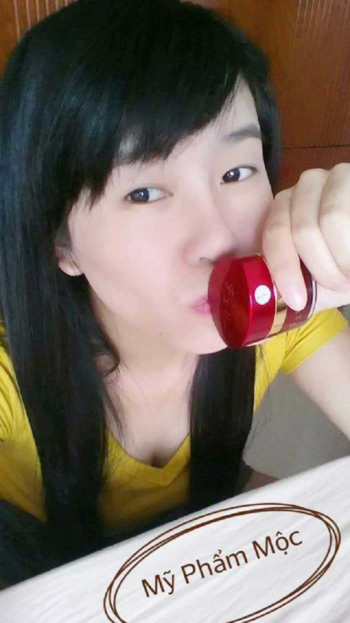 Nâng mũi bọc sụn