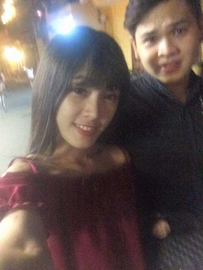 Nâng mũi bọc sụn
