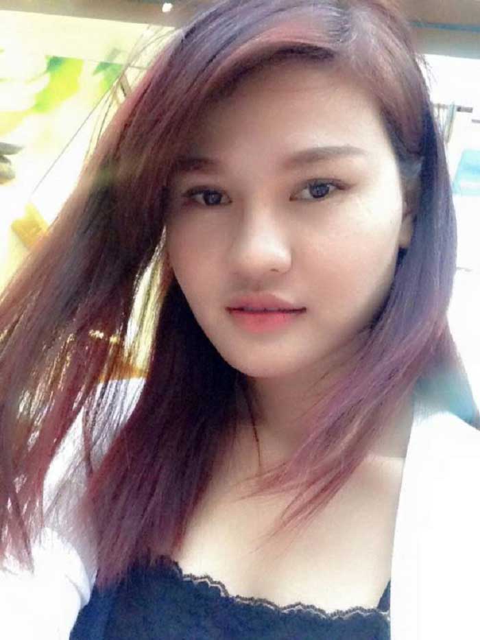 Cắt mí mắt