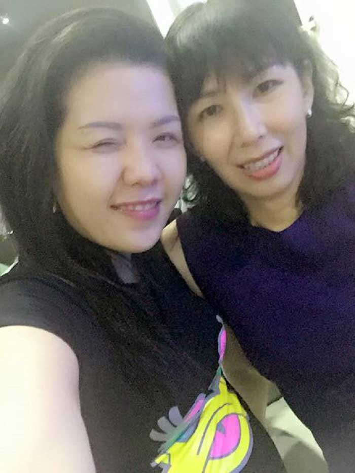 Cắt mí mắt