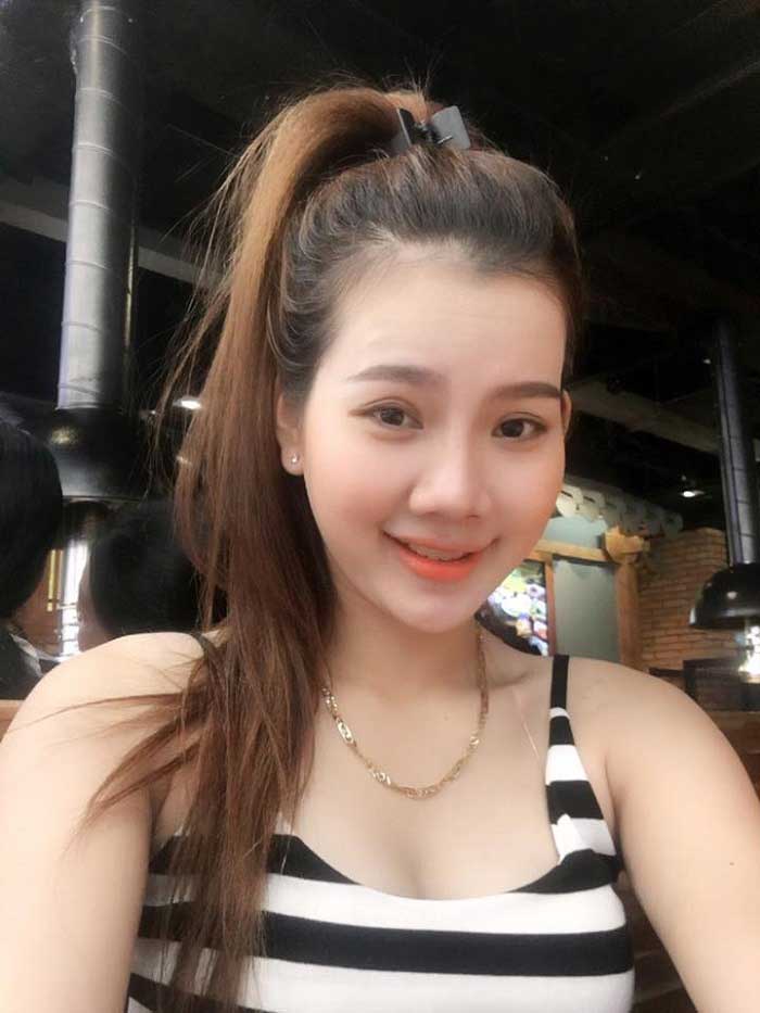 Nâng mũi bọc sụn