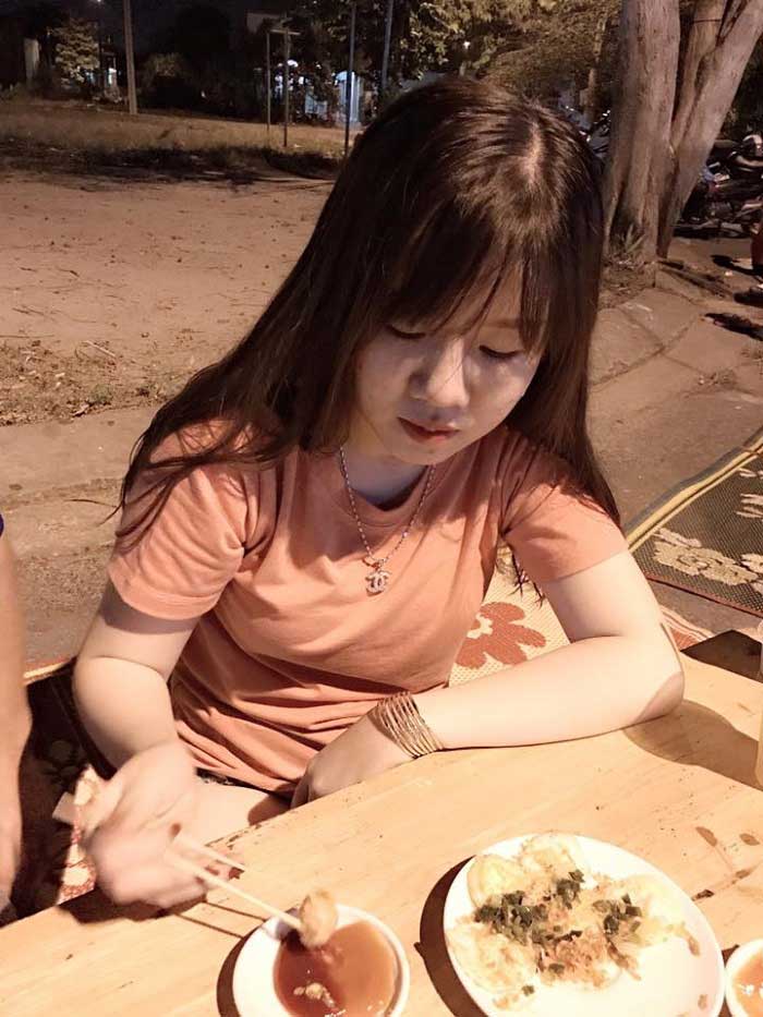 Nâng mũi Hàn Quốc