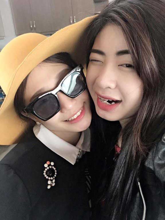 Độn cằm Độn cằm