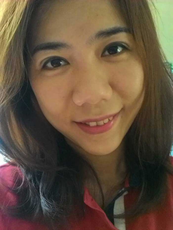 Bấm mí Hàn Quốc