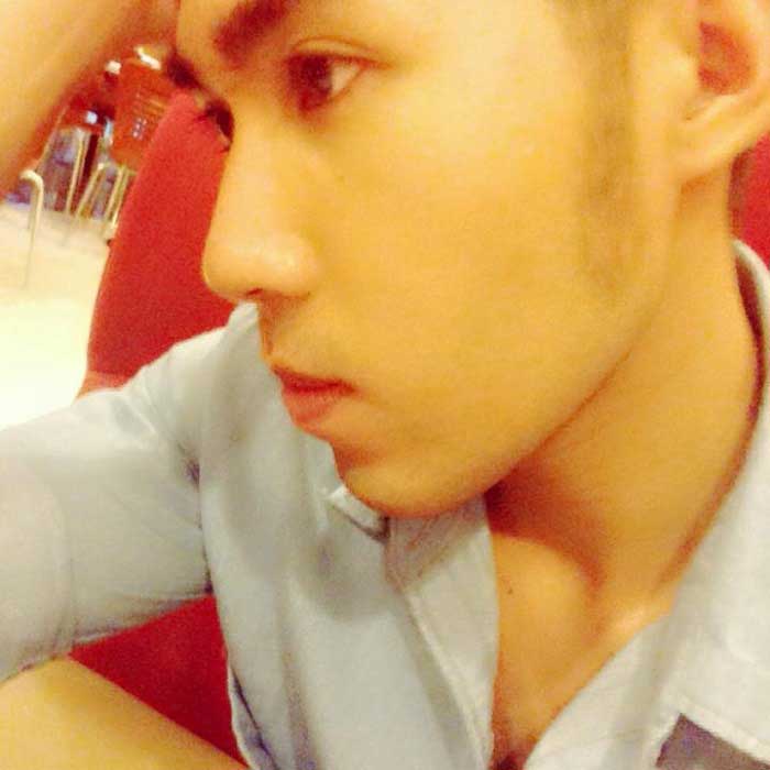 Lấy mỡ má