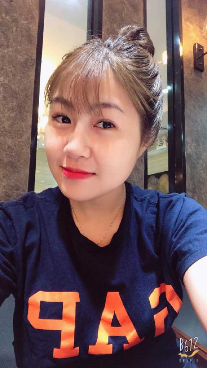 Nâng mũi bọc sụn