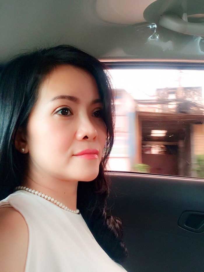 Nâng mũi bọc sụn Nâng mũi bọc sụn