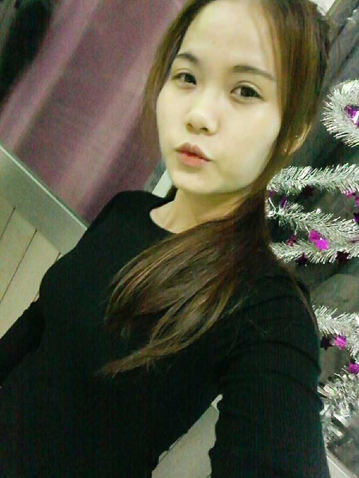 Nâng mũi bọc sụn