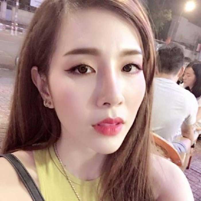 Nâng mũi Hàn Quốc
