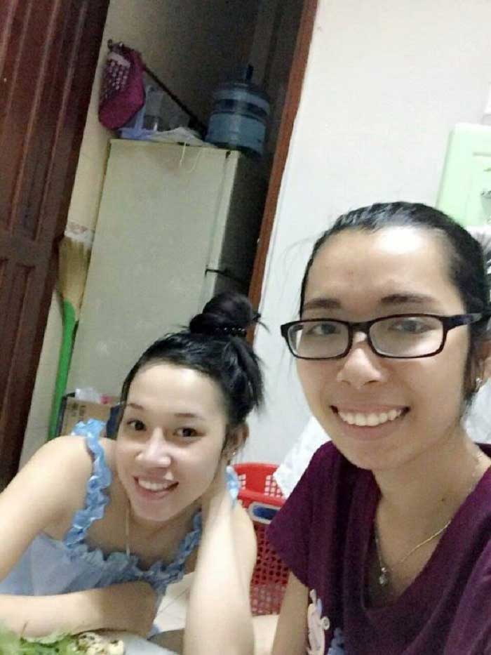 Nâng mũi bọc sụn