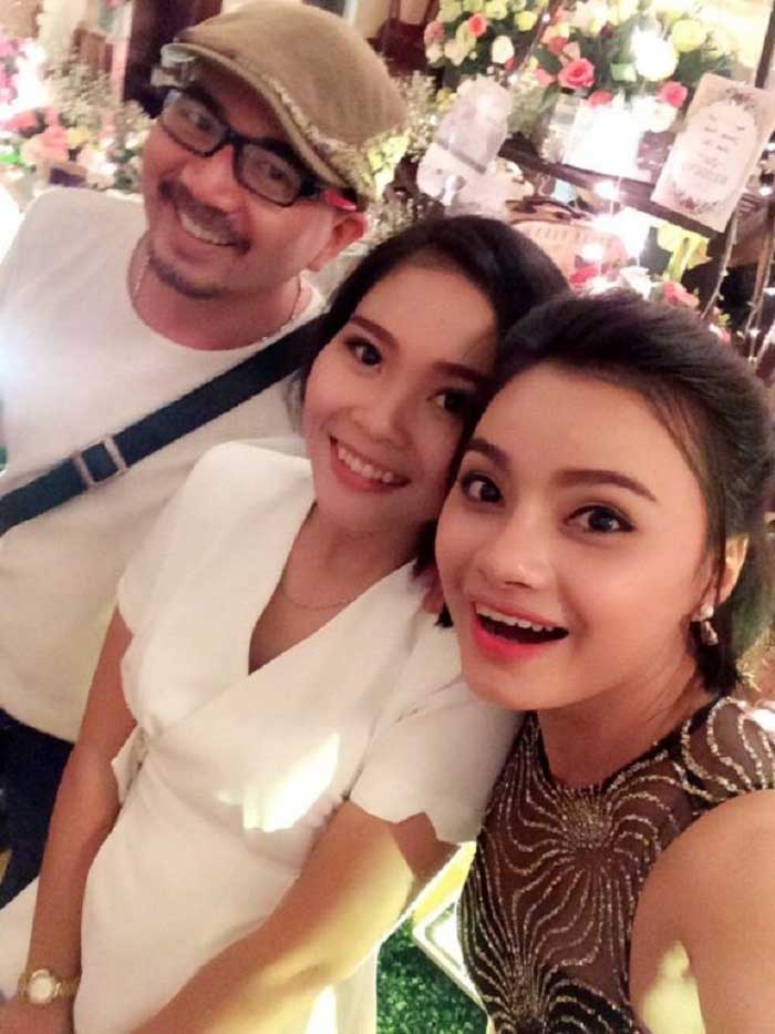 Nâng mũi bọc sụn