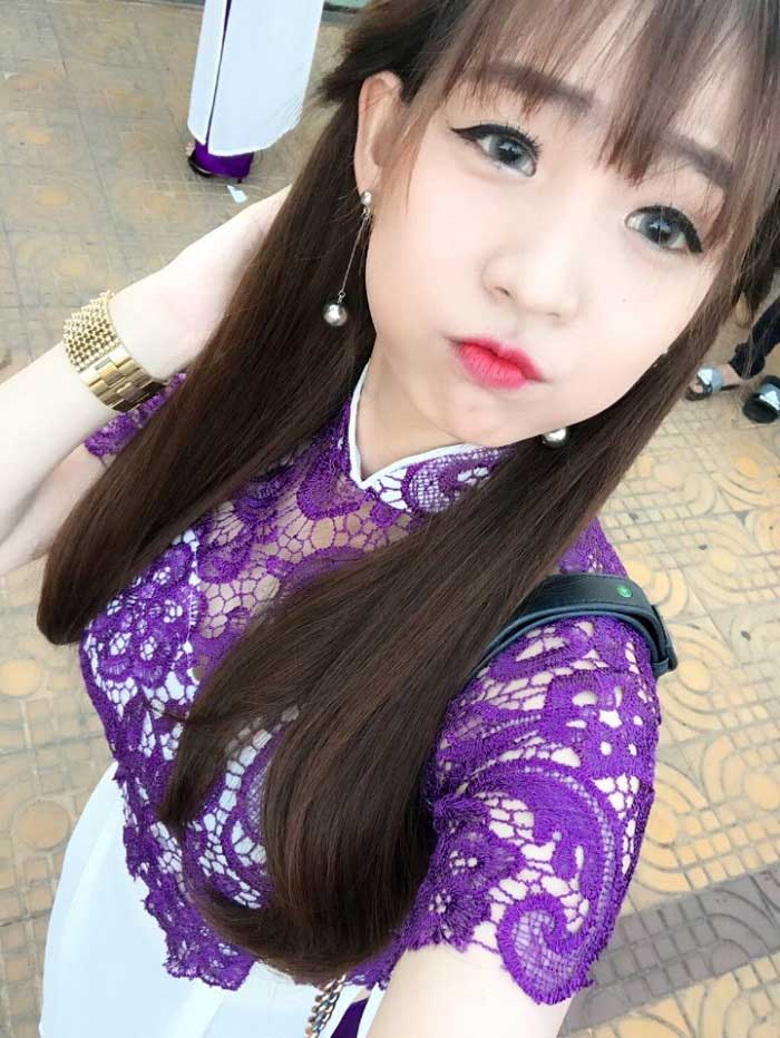 Nâng ngực nội soi