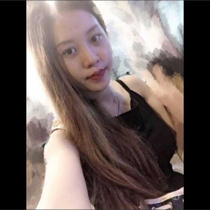 Nâng mũi bọc sụn