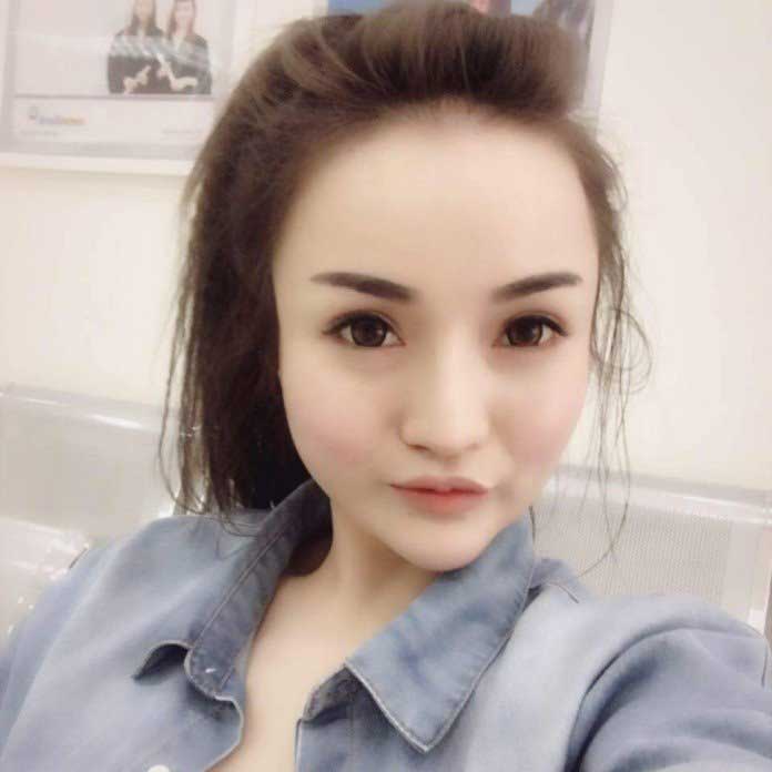 Độn cằm