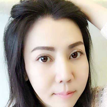 Nâng mũi S Line Nâng mũi S Line