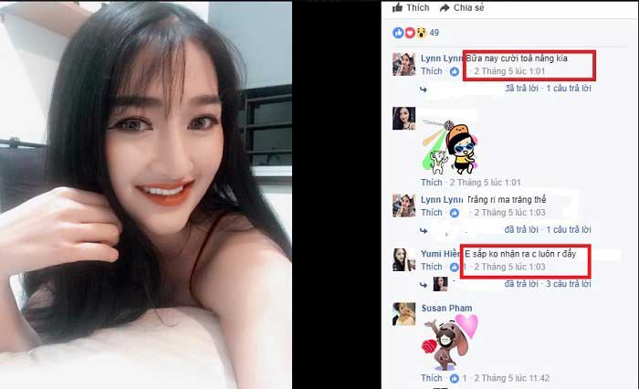 Gọt cằm