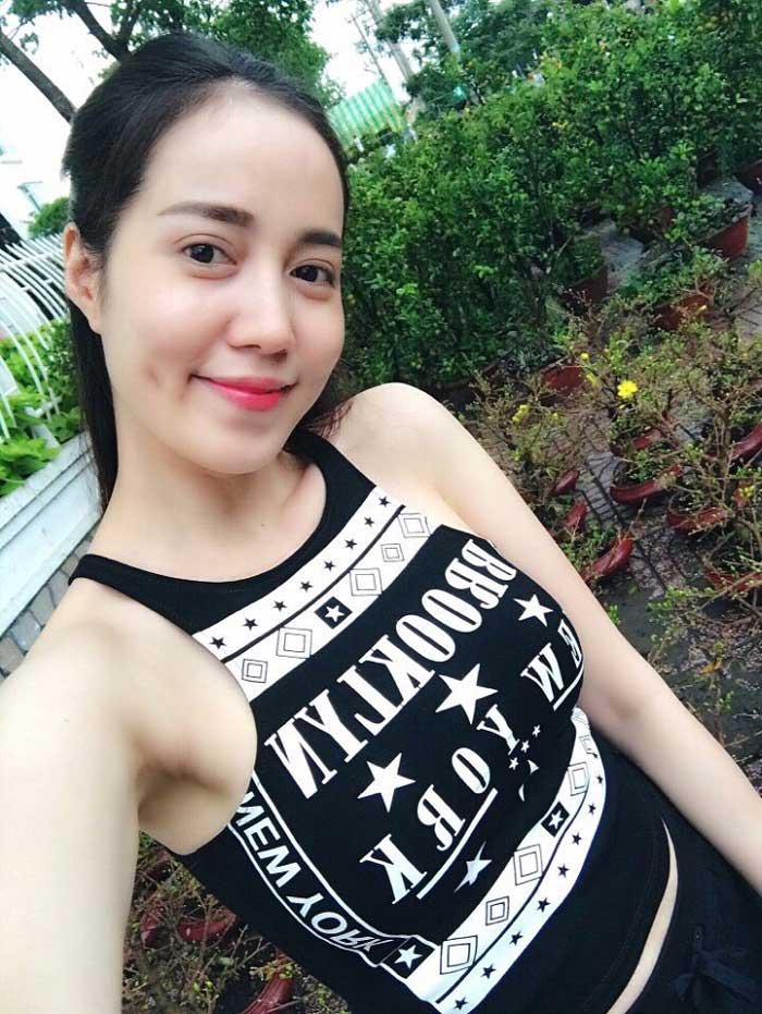 Cắt mí mắt