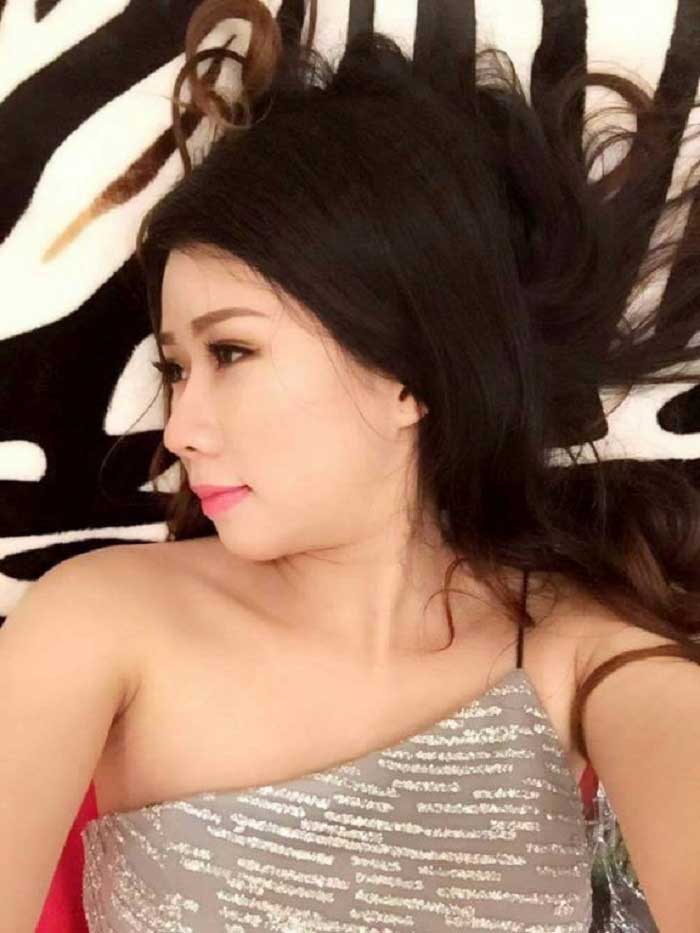 Nâng mũi bọc sụn