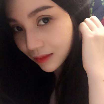 Nâng mũi S Line