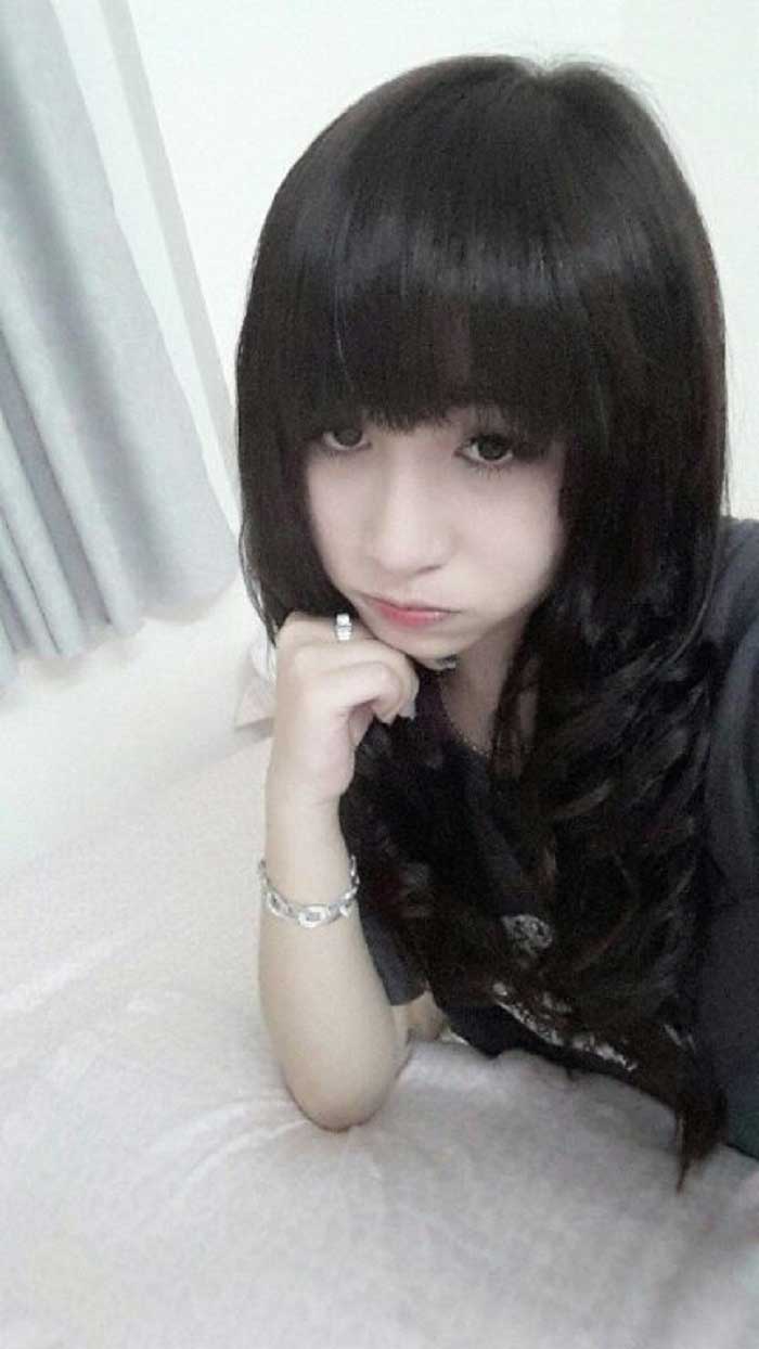 Nâng mũi bọc sụn
