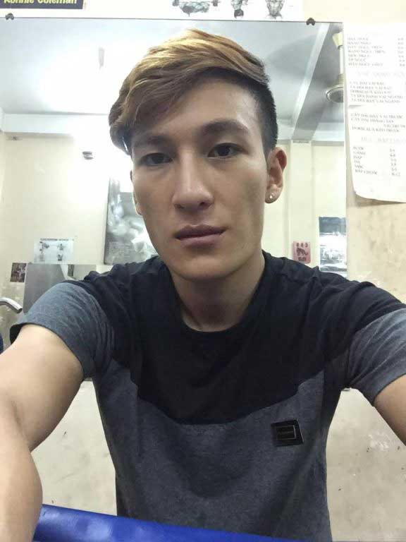 Làm đầy môi