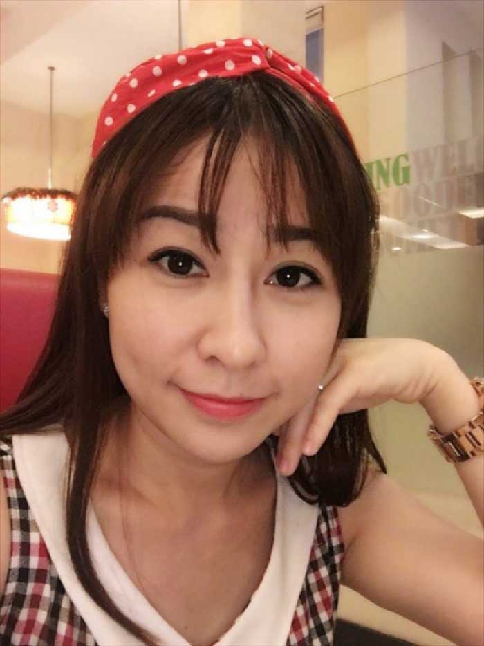 Cắt mí mắt