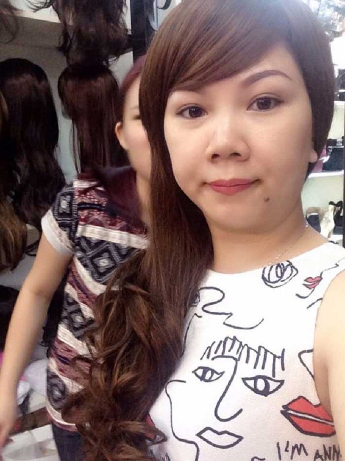 Cắt mí mắt