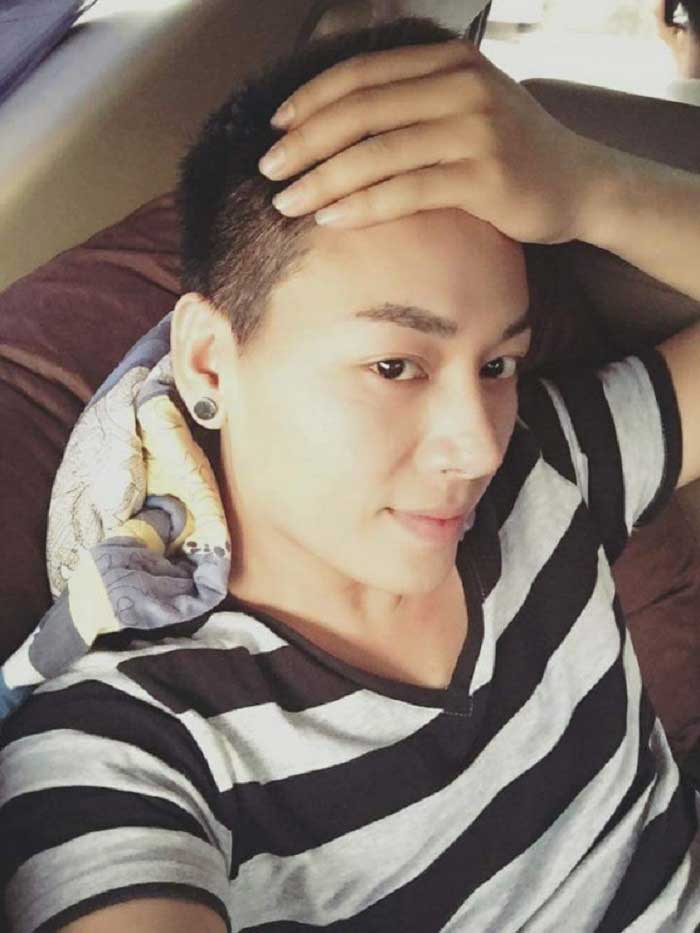 Nâng mũi bọc sụn