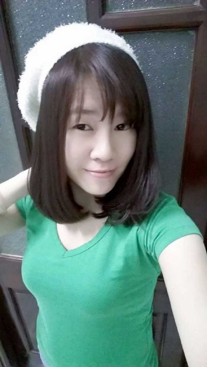 Nâng mũi bọc sụn