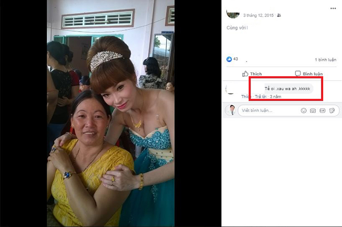 Nâng mũi bọc sụn