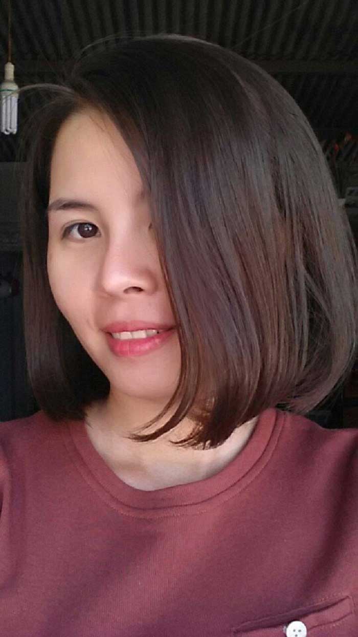 Nâng mũi bọc sụn Nâng mũi bọc sụn