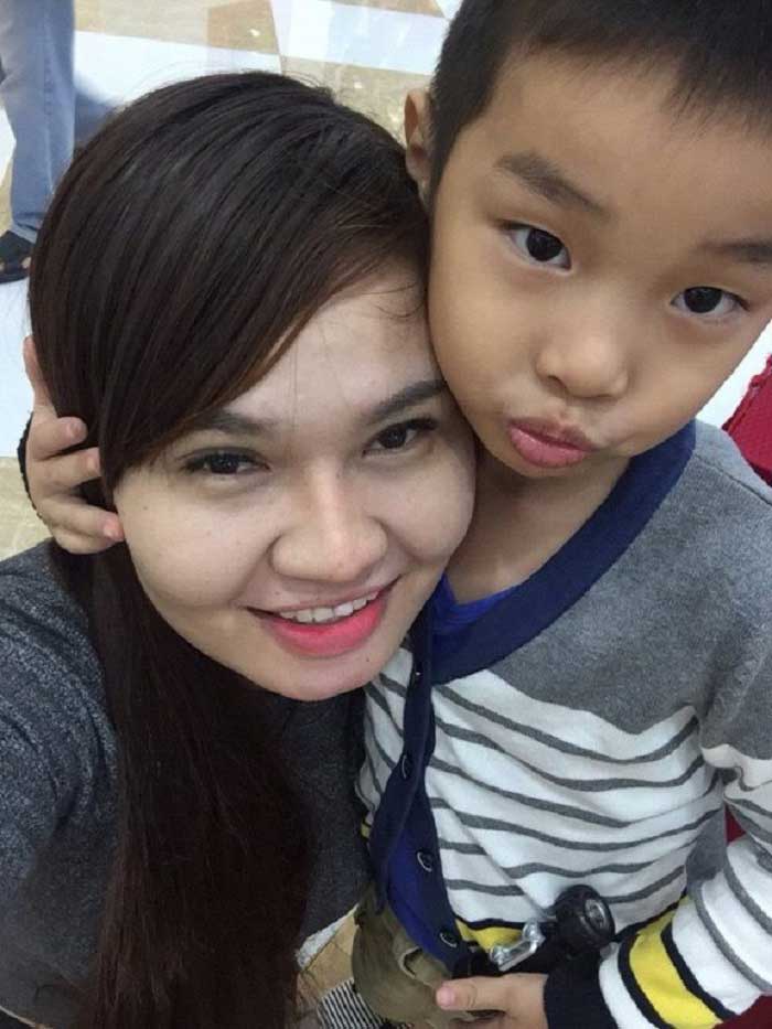 Cắt mí mắt