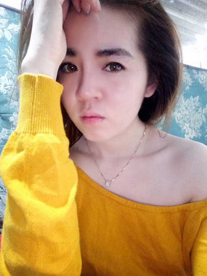 Nâng mũi Hàn Quốc
